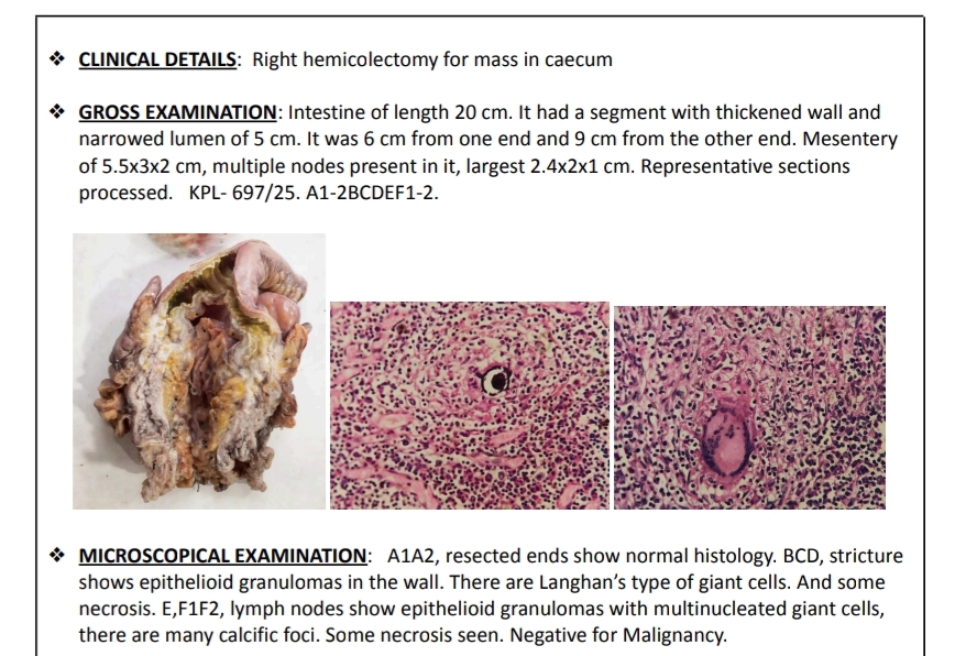 Kale PathLab Histopathology Report Sample